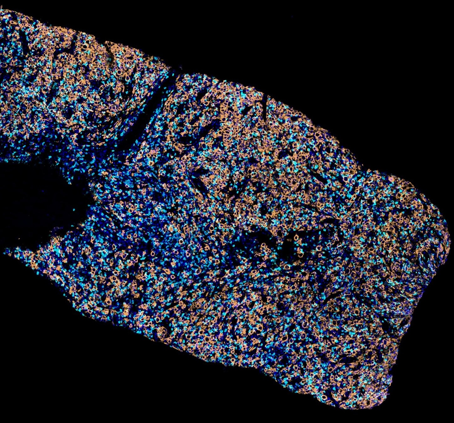 Fluorescent tissue
