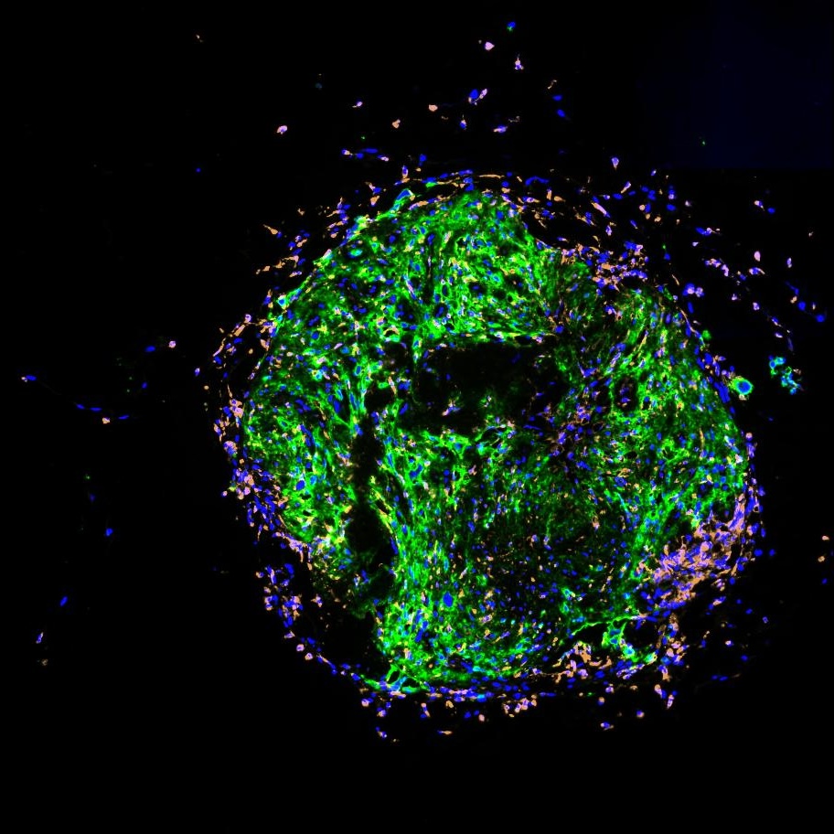 Organoid tissue