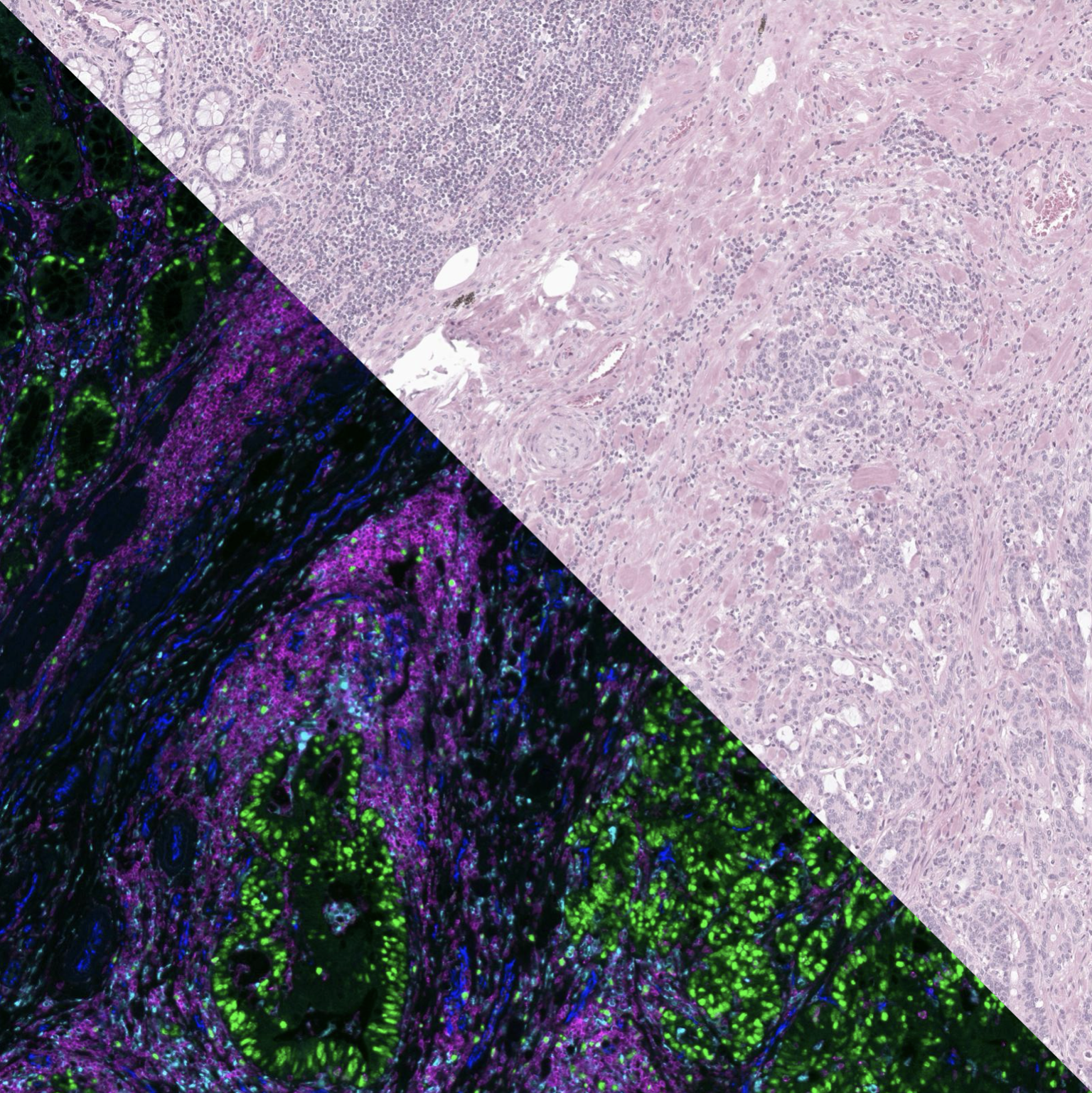 Lung TMA core